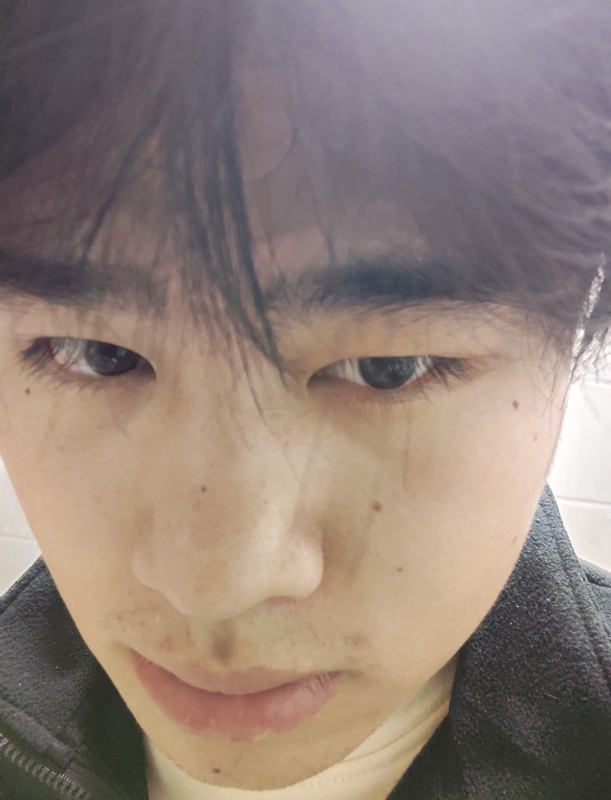 伤男的第一张照片--莆田交友网